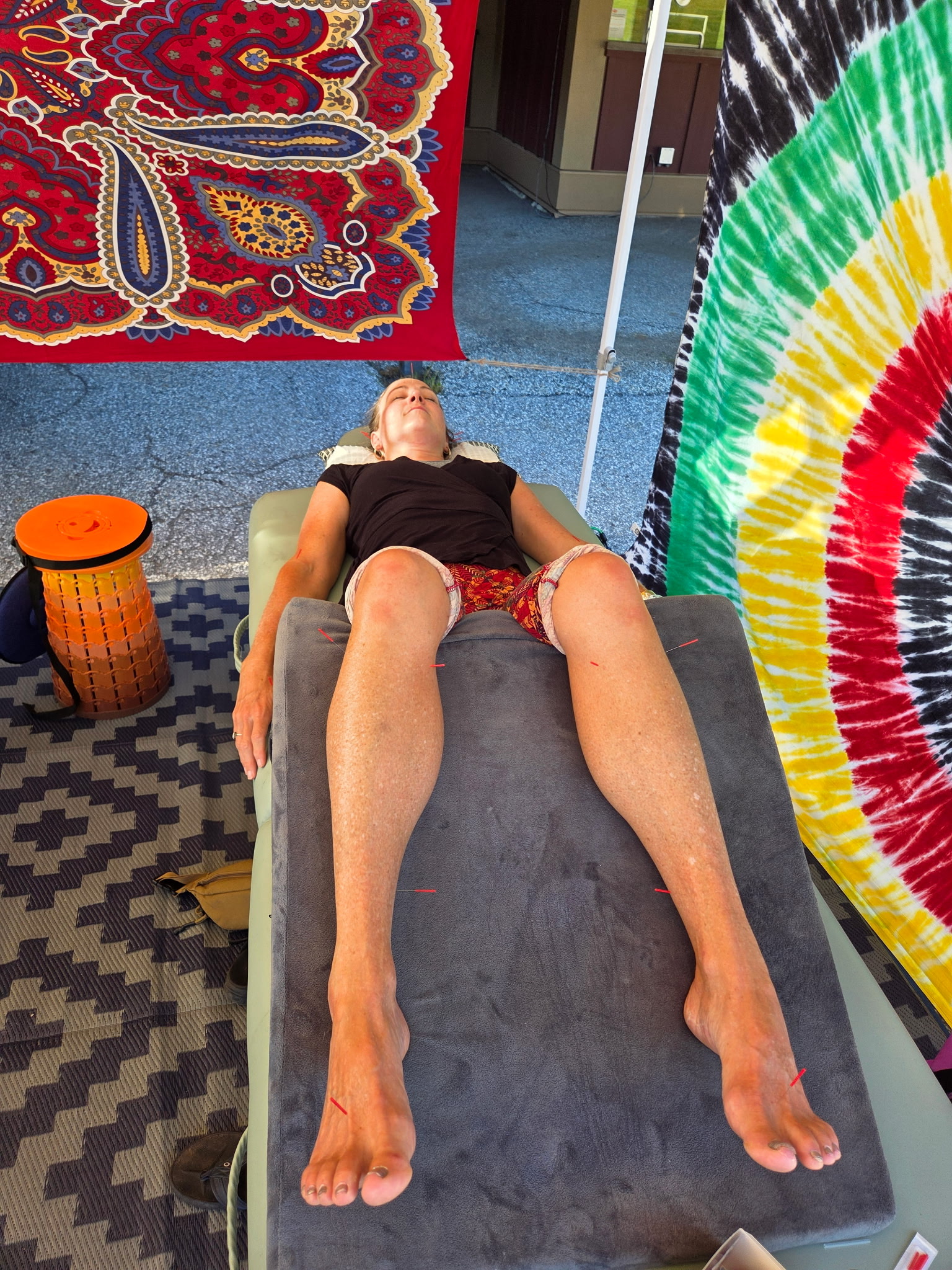 Acupuncture at Stratton's Transcend Fest, a Vermont yoga festival